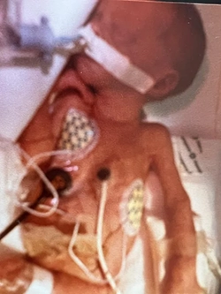 Myself weighing 1lb 13 oz in an incubator